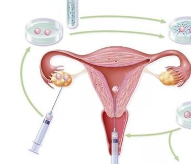 济南地区有哪些私立的机构可以做试管技术？马来西亚试管婴儿费用攻略